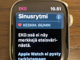 Apple Watch, Puhelintarvikkeet, Puhelimet ja tarvikkeet, Helsinki, Tori.fi